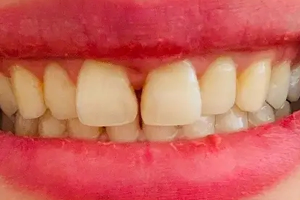 Before image