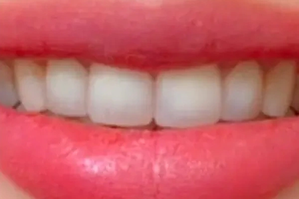 After image