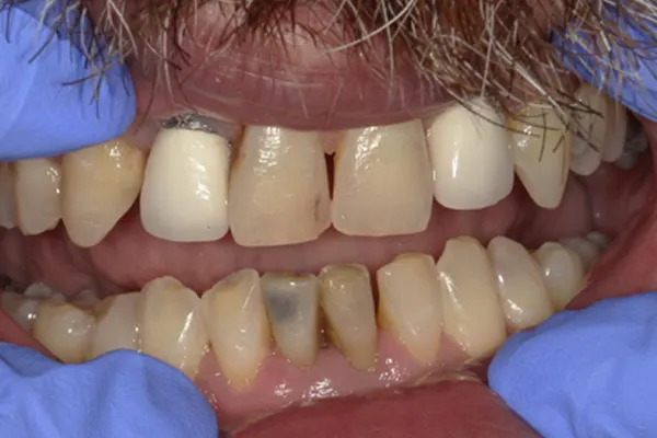 Before image