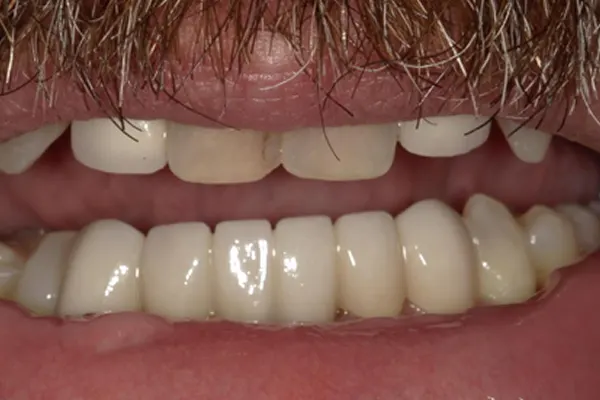 After image