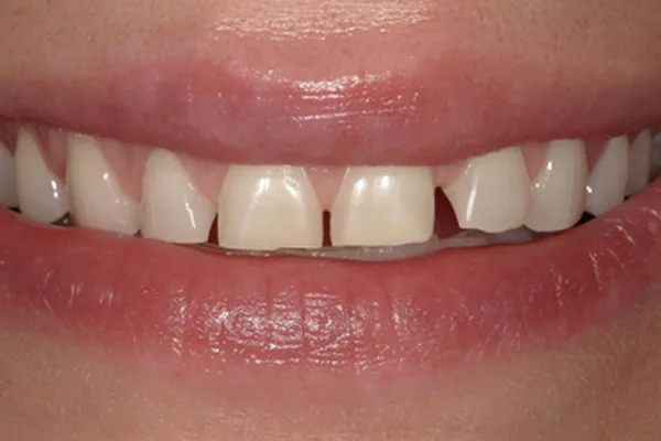 Before image