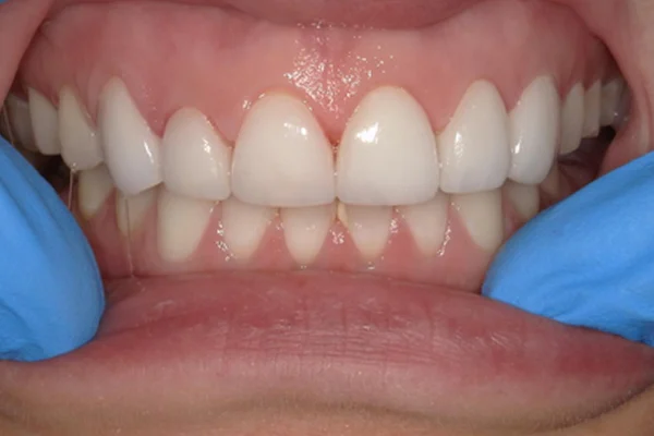 After image