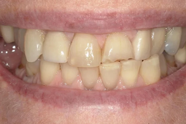 Before image