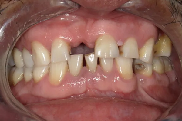 Before image