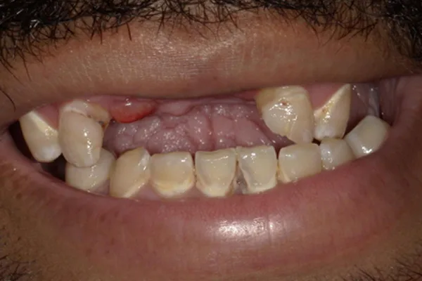 Before image