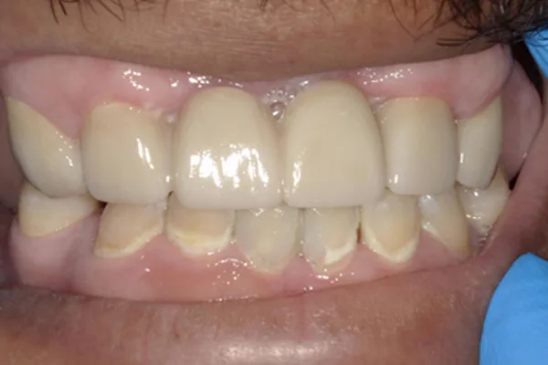 After image