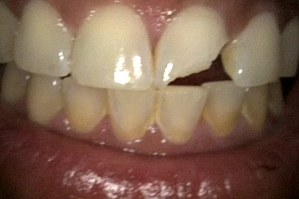 Before image