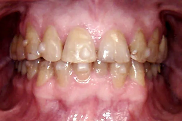 Before image