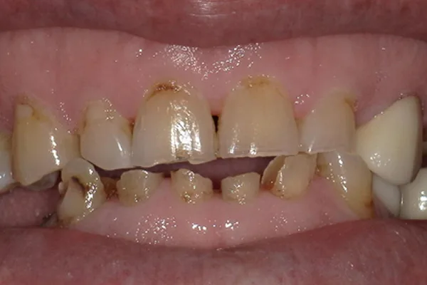 Before image