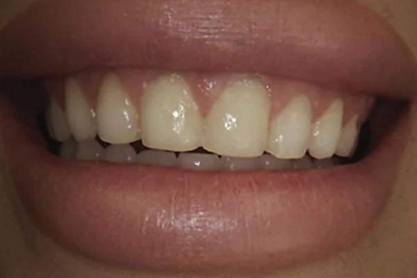 Before image