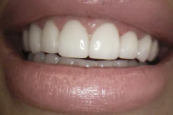 After image