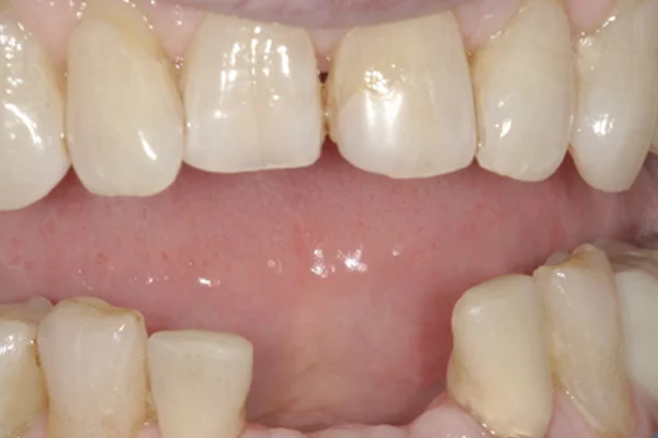 Before image
