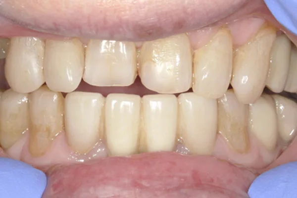 After image
