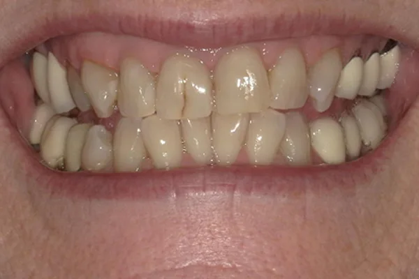 Before image