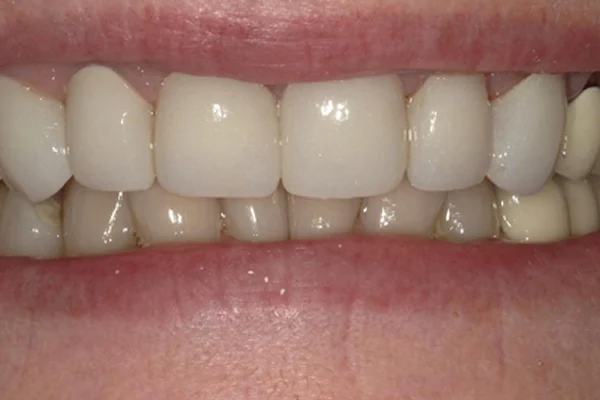 After image