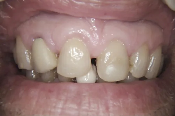 Before image