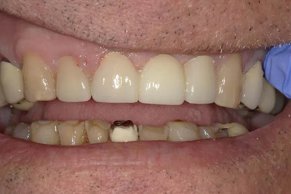 After image