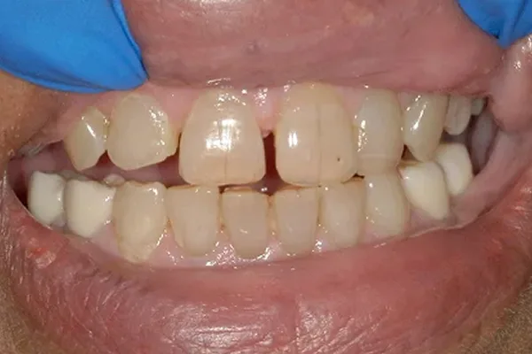 Before image