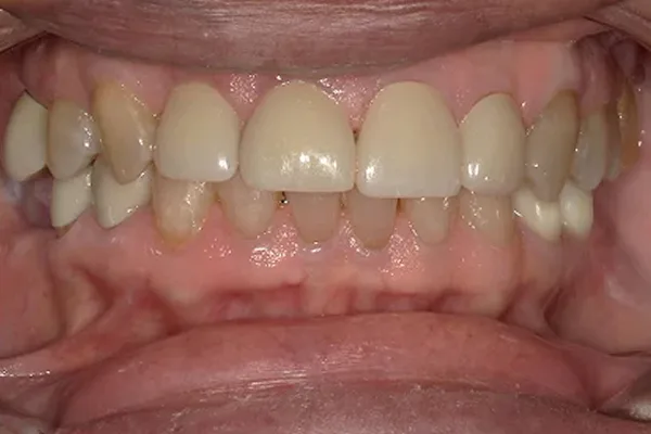 After image