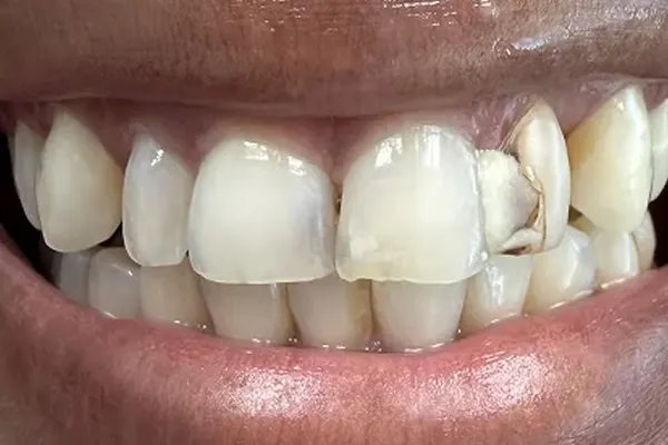 Before image