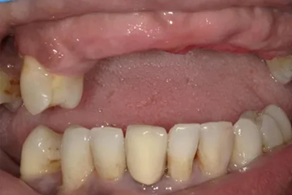 Before image
