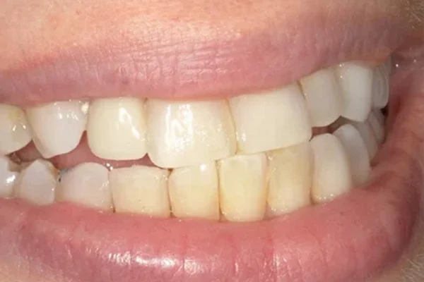 After image