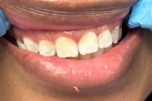Before image