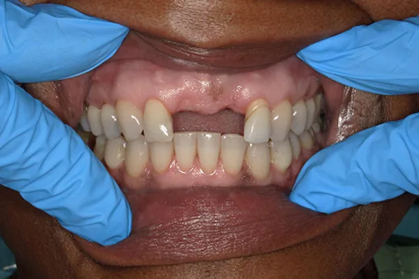 Before image