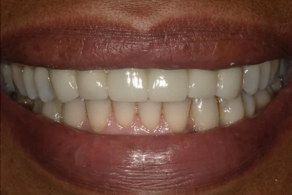 After image